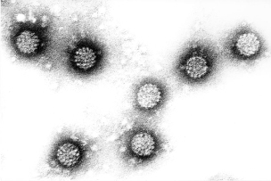 Papillomavirus manusia